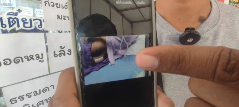 ปทุมธานี – พ่อร้องสื่อลูกชายมาบวชเณรถูกพระผู้ช่วยพี่เลี้ยงตีก้นบาดเจ็บ