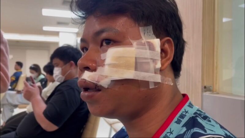 กาดร์ผับดังเมืองสงขลา กร่างซ้อมนักท่องเที่ยวบาดเจ็บ ซึ่งที่ผ่านมามีนักท่องเที่ยวโดนรุมทำร้ายร่างกาย โดยการใช้ขวดเบียร์รุมตีจนได้รับบาดเจ็บเล็กน้อยจนถึงบาดเจ็บสาหัส พอเข้าแจ้งความกับเจ้าหน้าที่ตำรวจสถานีตำรวจภูธรเมืองสงขลาคดีกลับเงียบหาย