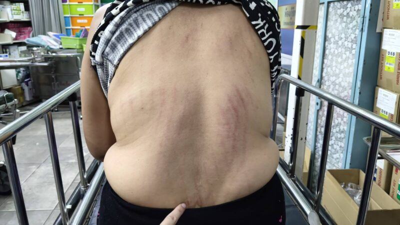 ปทุมธานี – ยายอุ้มหลานวัย 2 ขวบหงายหลังตกบันไดเลื่อนสถานีรถไฟรังสิตบาดเจ็บทั้งคู่