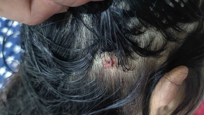 อดีตสามีทหารยศจ่าควงปืนและมีดบุกห้องพักอดีตภรรยา ก่อนซ้อมทำร้ายร่างกายบังคับโดดตึก 5 ชั้นบาดเจ็บ